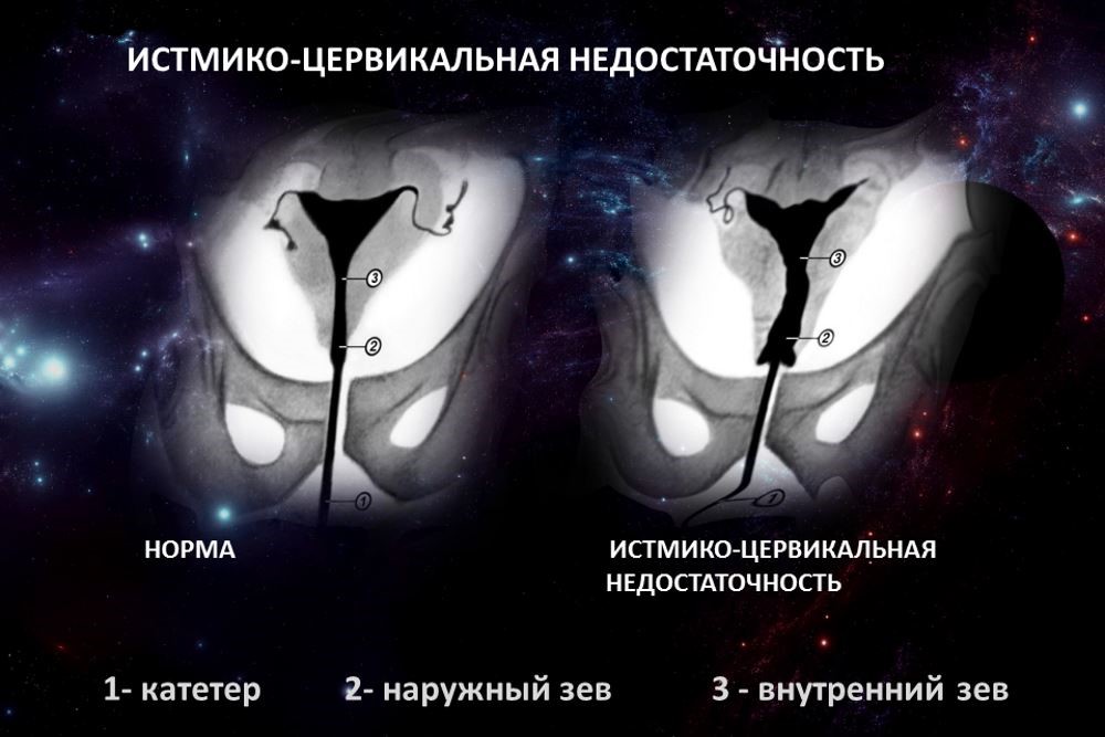 УЗИ шейки матки (цервикометрия) при беременности, цены в клинике Evolutis Clinic в Москве